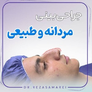 rhinoplasty-27