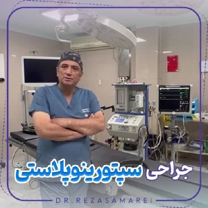 rhinoplasty-35