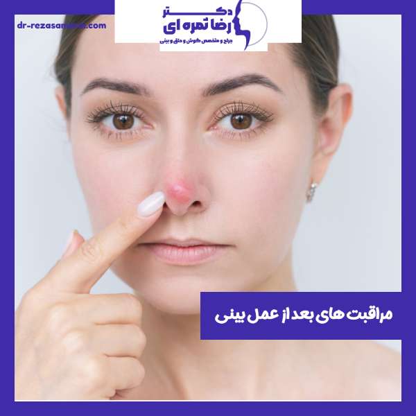 مراقبت های بعد از عمل بینی