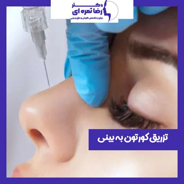 تزریق کورتون به بینی