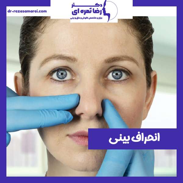 عمل انحراف بینی