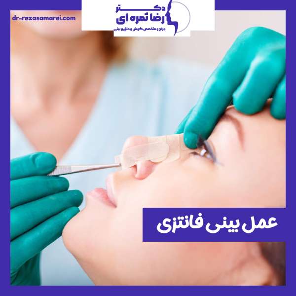 عمل بینی فانتزی- دکتر رضا ثمره ای -dr-rezasamarei.com