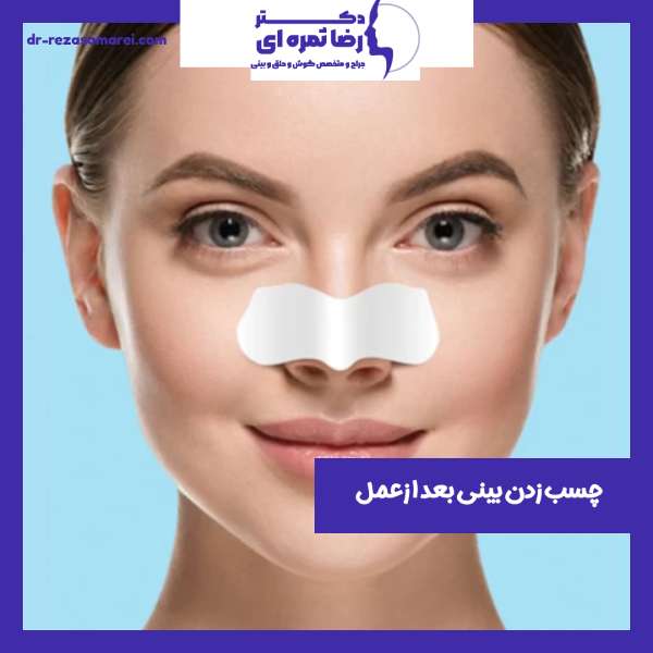 چسب زدن بینی بعد از عمل