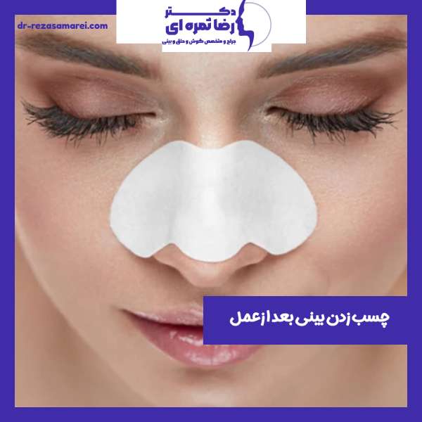 عکس چسب زدن بینی بعد از عمل 