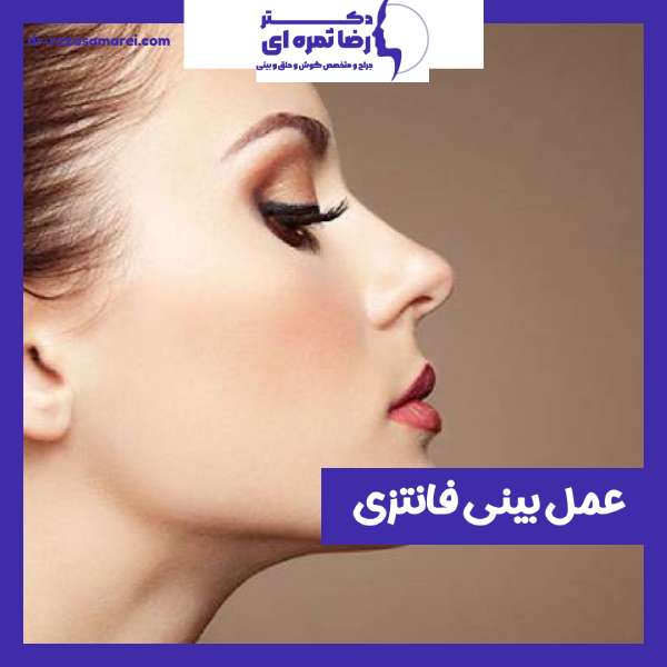 عمل بینی فانتزی