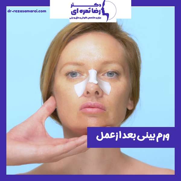 ورم بینی بعد از عمل