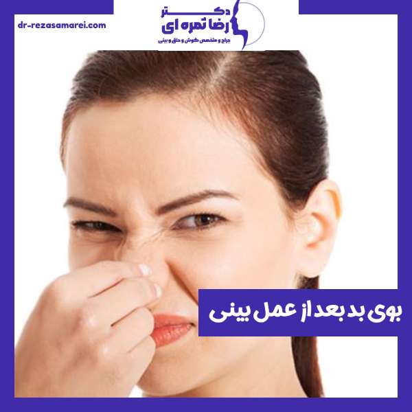 بوی بد بینی بعد از عمل