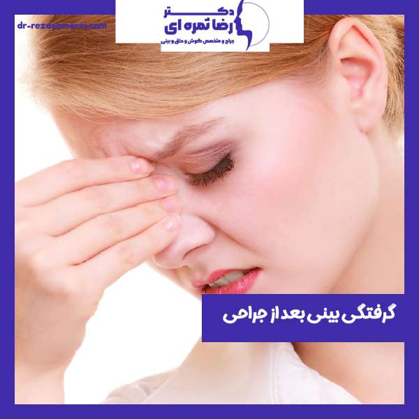 گرفتگی بینی بعد از عمل بینی