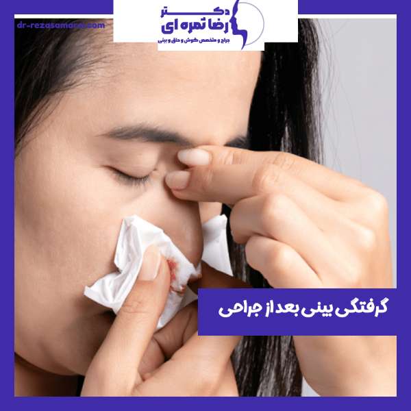 گرفتگی بینی بعد از جراحی- دکتر رضا ثمره ای -dr-rezasamarei.com