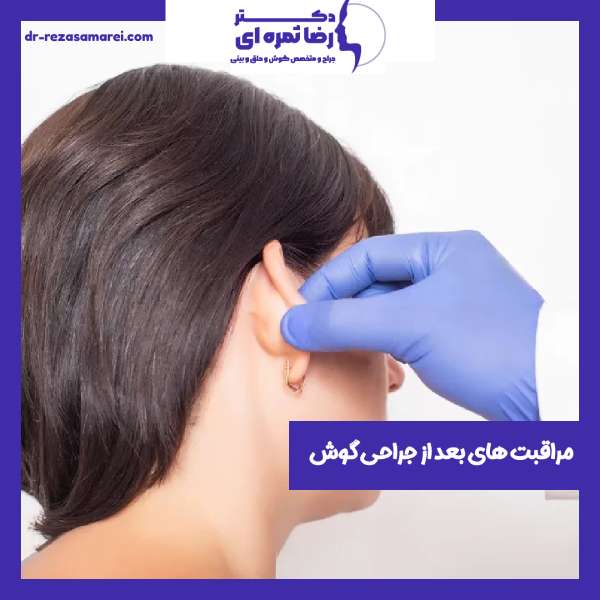 مراقبت های بعد از اتوپلاستی یا جراحی گوش