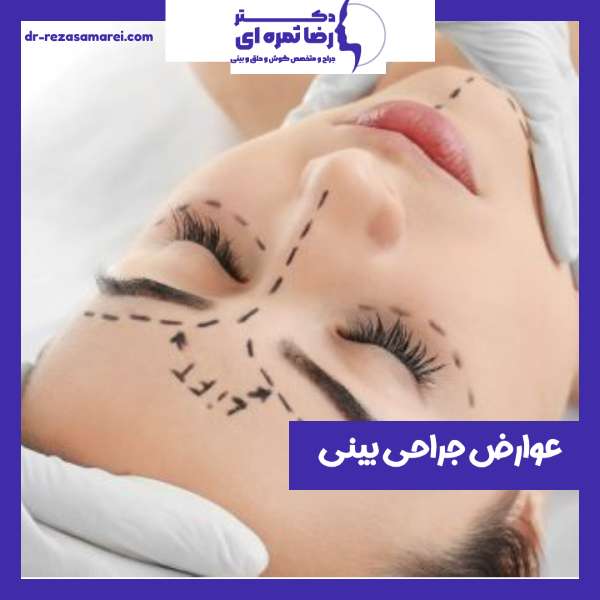 عوارض جراحی بینی