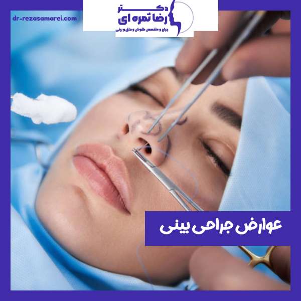 عوارض جراحی بینی