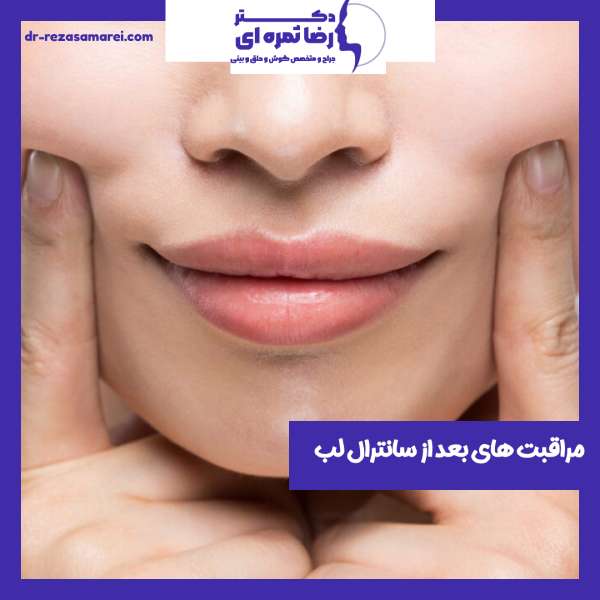 مراقبت های بعد از سانترال لب