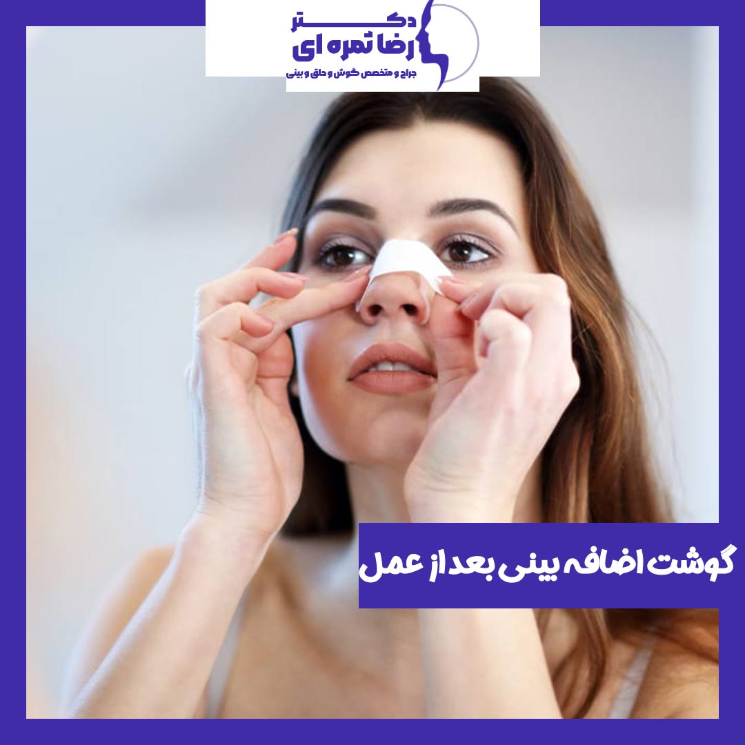 گوشت اضافه بعد از جراحی بینی - دکتر رضا ثمره ای