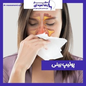 پولیپ بینی - دکتر رضا ثمره ای