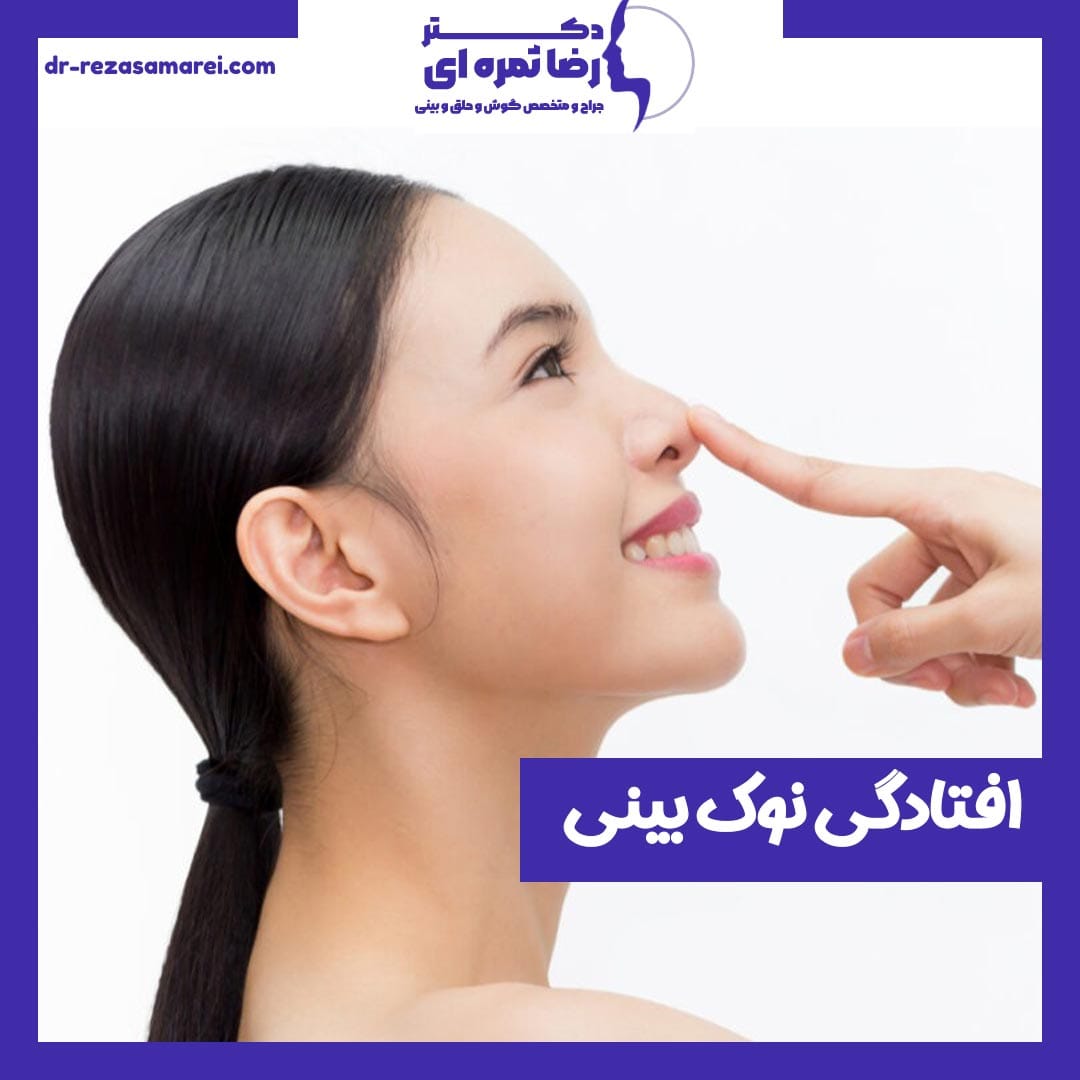 افتادگی نوک بینی بعد از جراحی - دکتر رضا ثمره ای