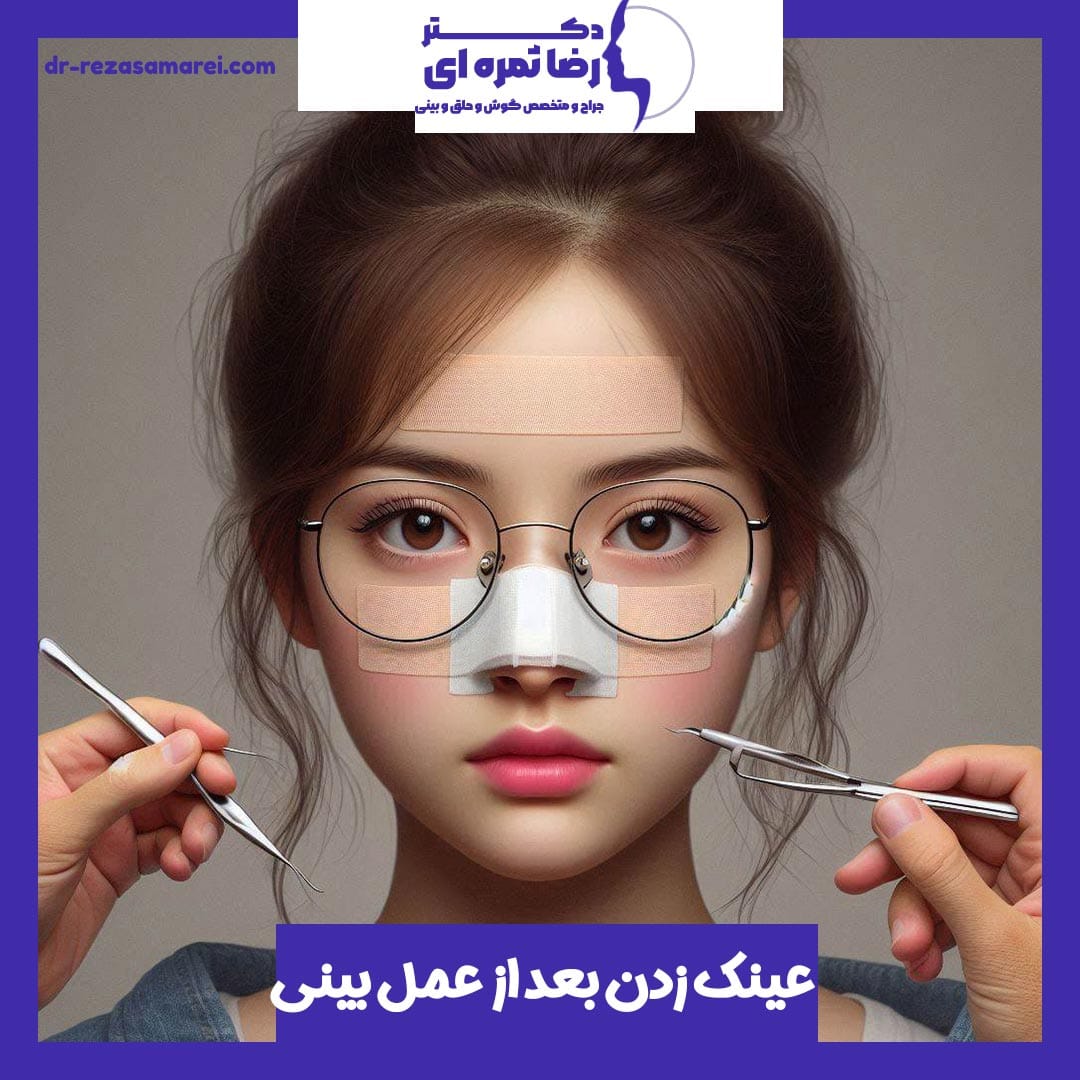 عینک زدن بعد از عمل بینی - دکتر رضا ثمره ای