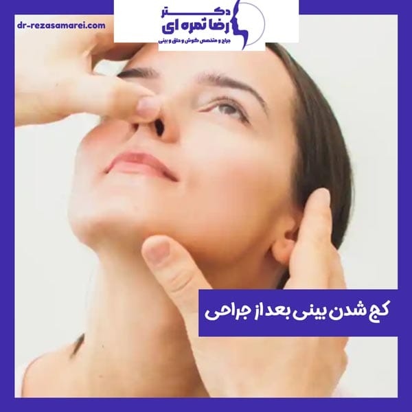 کج شدن بینی بعد از جراحی