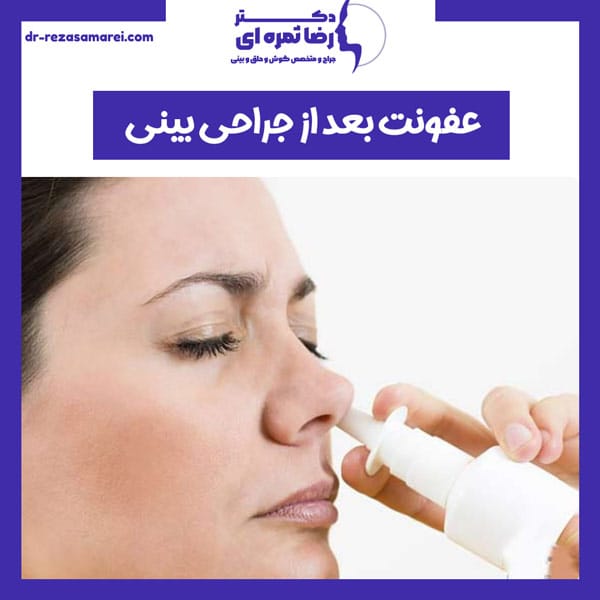 عفونت بعد از جراحی بینی