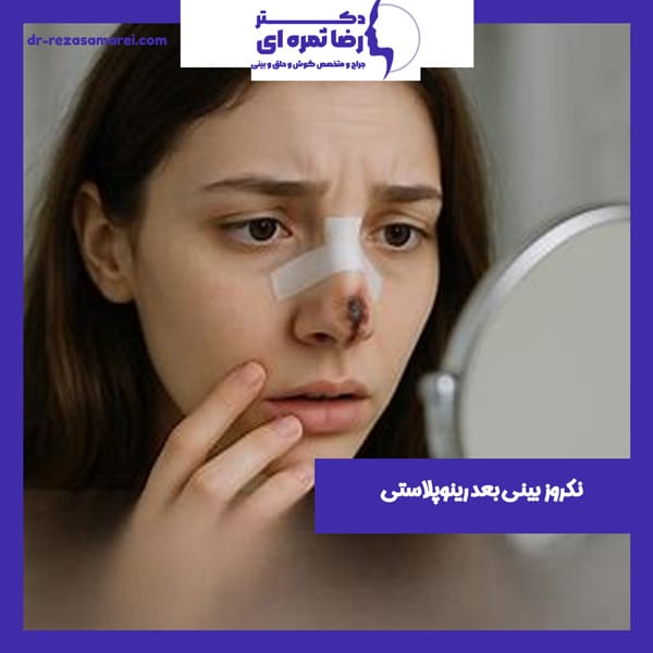 نکروز بینی بعد از عمل بینی - دکتر رضا ثمره ای - dr-rezasamarei.com