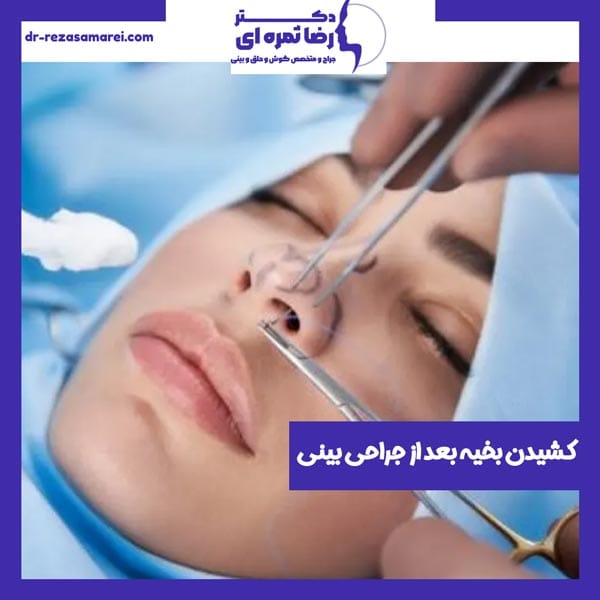 کشیدن بخیه بعد از جراحی بینی