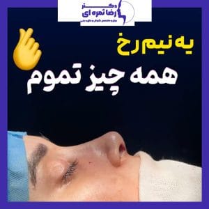 عکس نمونه کار بهترین جراح بینی ارومیه 1- دکتر ثمره ای - dr-rezasamarei.com