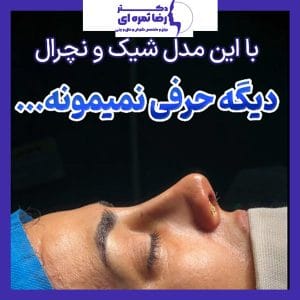 عکس نمونه کار بهترین جراح بینی ارومیه 3- دکتر ثمره ای - dr-rezasamarei.com
