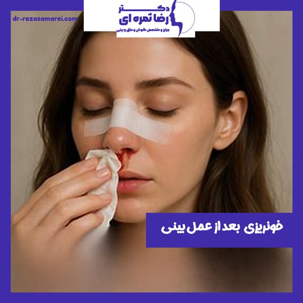 خونریزی بعد از عمل بینی - دکتر رضا ثمره ای - dr-rezasamarei.com