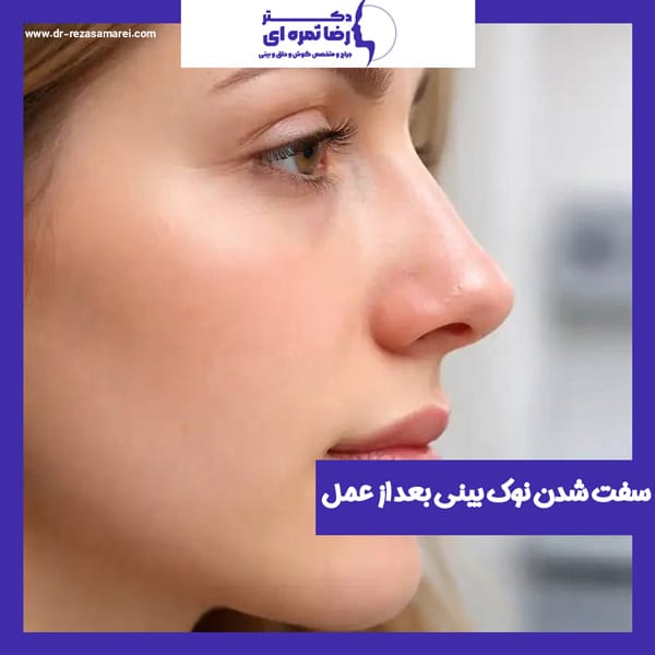 سفت شدن نوک بینی بعداز عمل - دکتر رضا ثمره ای